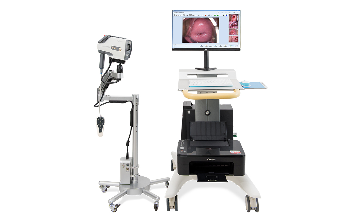 数码电子阴道镜基本功能