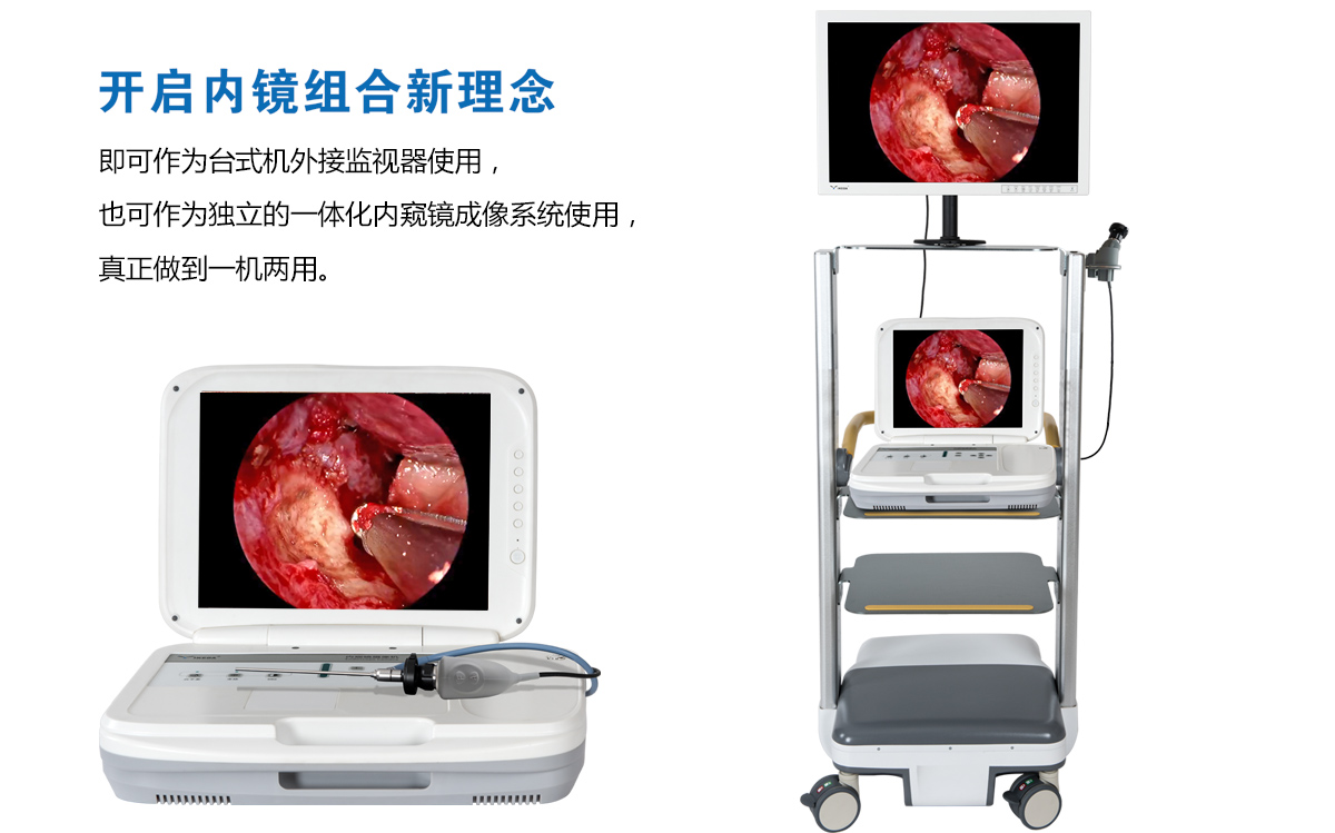 用户反馈：YKD-9003内窥镜摄像机获得好评