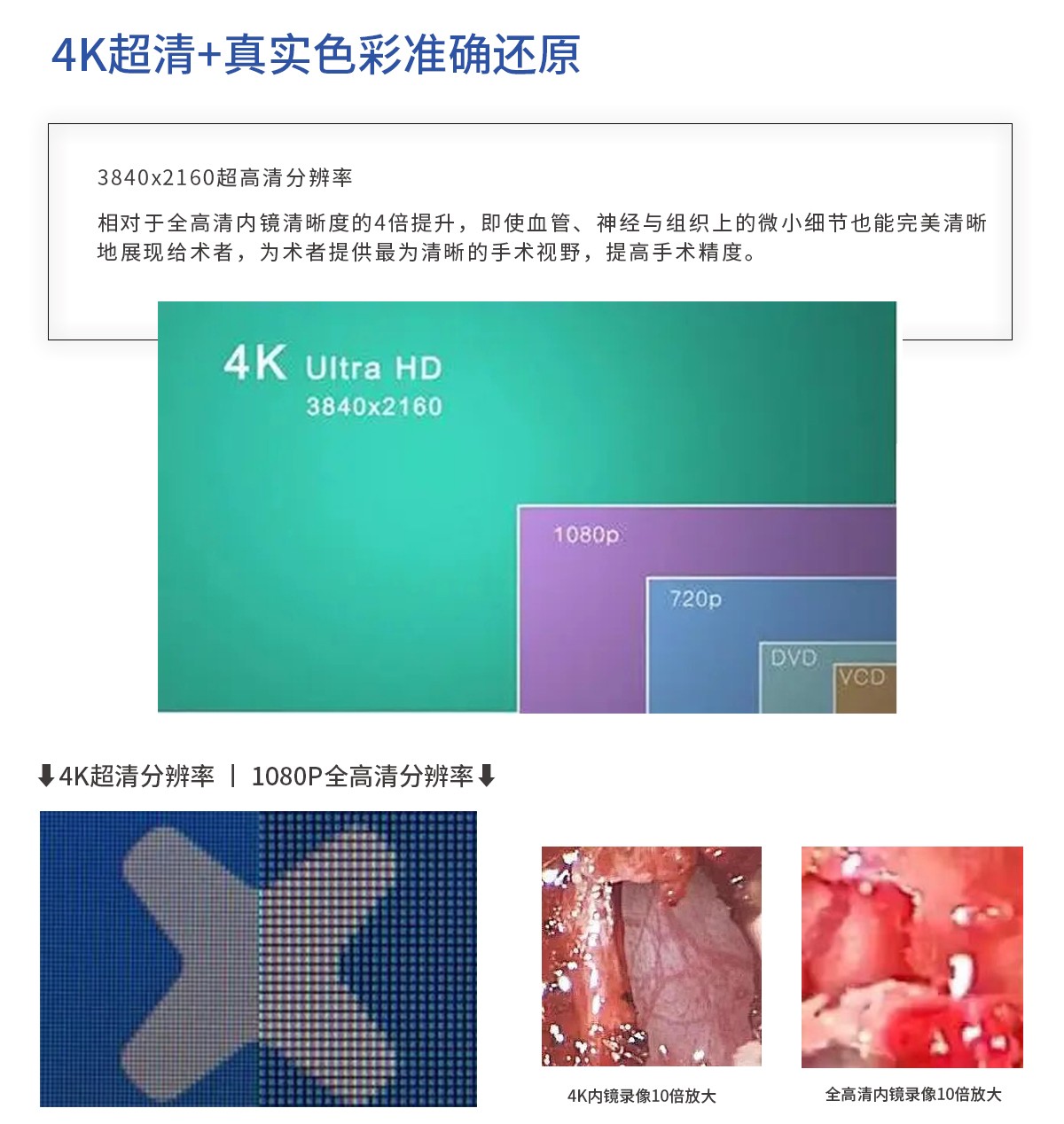 【4K医用内窥镜摄像系统】您的第一台“4K”找到了吗？