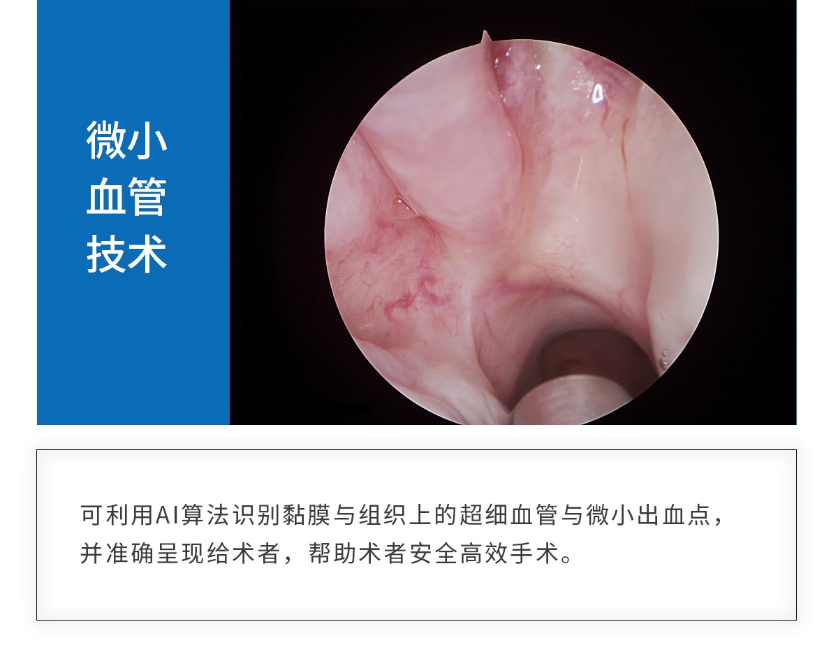 【4K医用内窥镜摄像系统】您的第一台“4K”找到了吗？