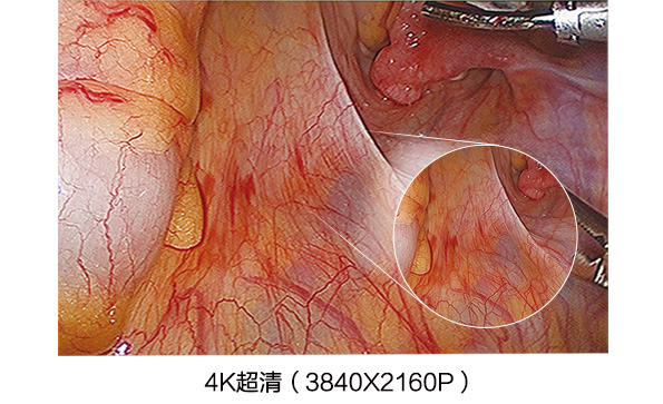 为什么选择4K超高清内窥镜摄像系统