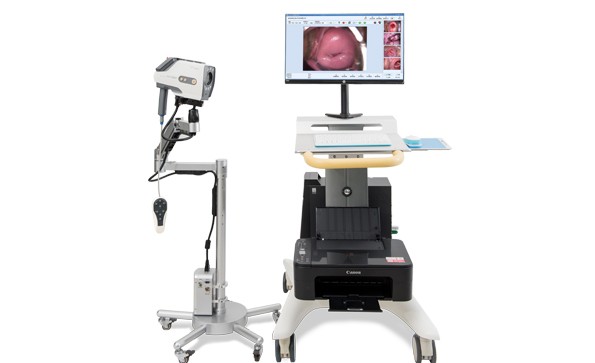 数码电子阴道镜与TCT技术诊断早期宫颈癌